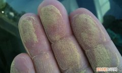 去除衣服上花粉的 7 个步骤是什么