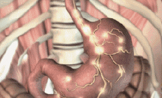 vegtometo解酒糖怎么样有副作用吗