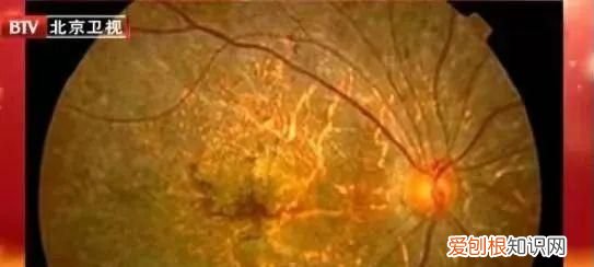 一元一斤菠菜怎么吃,3毛钱一斤的菠菜