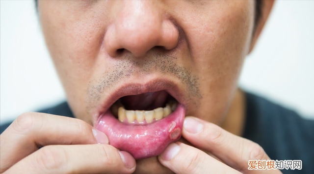 为什么吃橘子可以缓解咳嗽