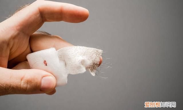 手指被502胶水粘住了,怎么办?