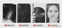 碱性洗发水有哪些？