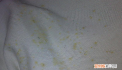 发霉的帽子怎么清洗，如何去除帽子上的霉斑