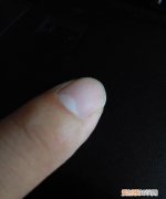 指甲凹陷是什么原因，指甲上有凹陷是怎么回事