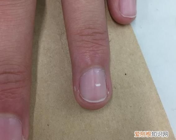 指甲上有白点怎么回事,指甲有白点是什么原因
