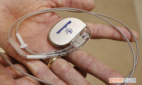 临时起搏器能用多久,国产临时心脏起搏器上市公司