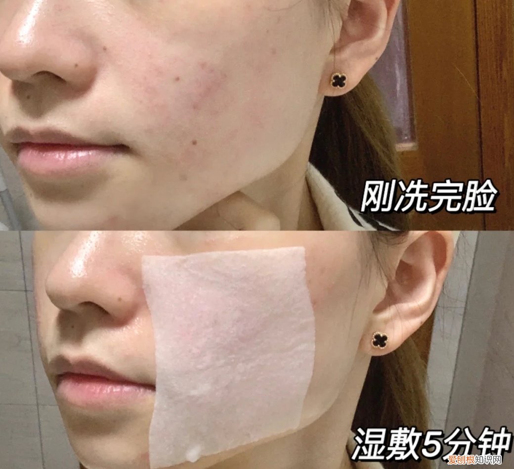 雅漾舒护活泉水喷雾多少钱