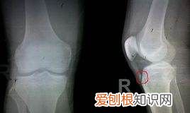 长跑能长高吗,长跑会影响长高