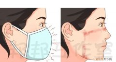 口罩的痘痘怎么办，带口罩脸上长了很多痘痘怎么办