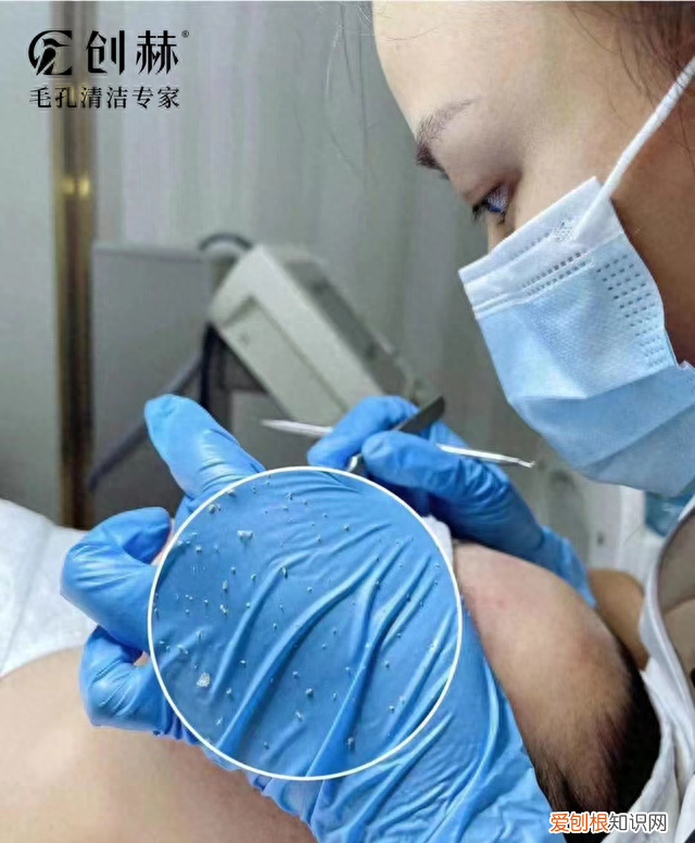 夏日毛孔清洁必备