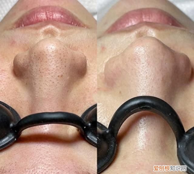 夏日毛孔清洁必备