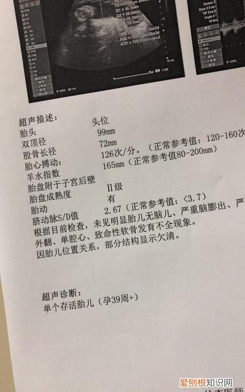 38周双顶径95是头大,36周双顶径95mm头大能顺产不生吗