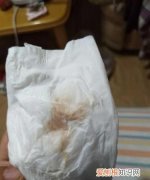 经后0天有褐色分泌物怎么回事，月经第十天还有褐色分泌物正常吗