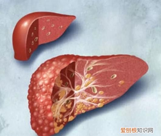 闷油是肝有问题，脂肪肝的症状有哪些