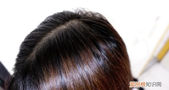 碘伏洗头头发有伤害