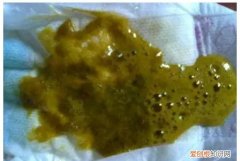 宝宝拉绿便的原因及解决方法,七个月宝宝大便是绿的什么原因