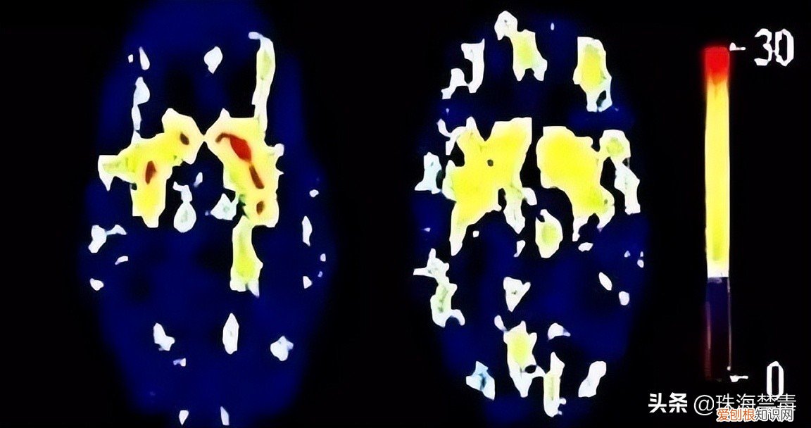 渭南澄城一大妈竟然用铝锅菜刀就能自制毒品“锭锭”，非法牟利5000元被抓