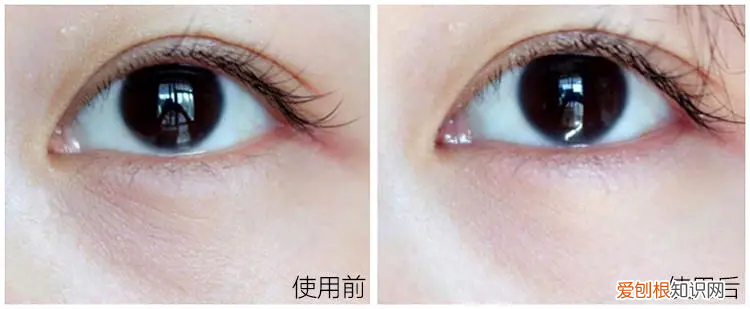 马应龙眼霜效果怎么样