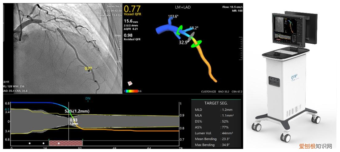 心血管检测仪怎么看多少钱一台
