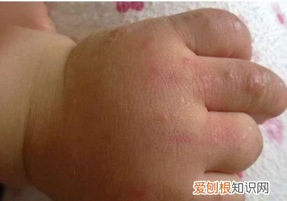 4岁男宝易过敏体质怎么能改善 过敏体质怎么改善最有效的方法