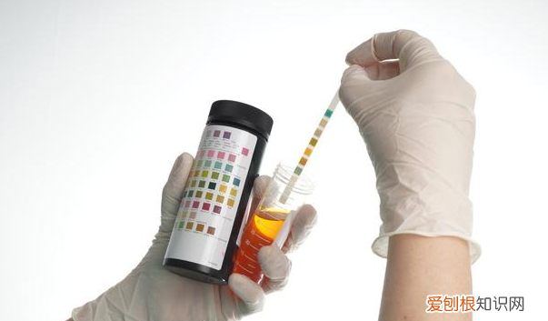 尿酸降到320了还吃不吃非布司他 尿酸高平时多吃什么食物