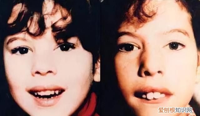 塌鼻子鼻孔大怎么做好看