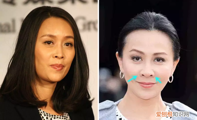 塌鼻子鼻孔大怎么做好看