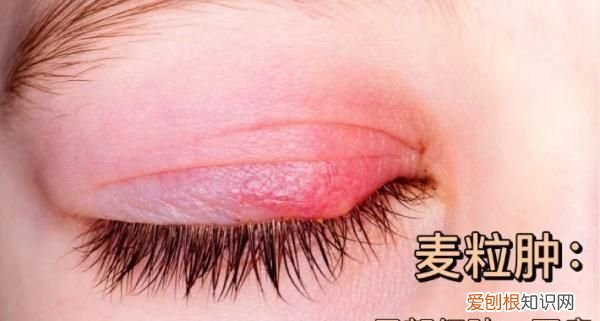 长期关灯玩手机致眼部囊肿 熬夜关灯玩手机后眼部囊肿