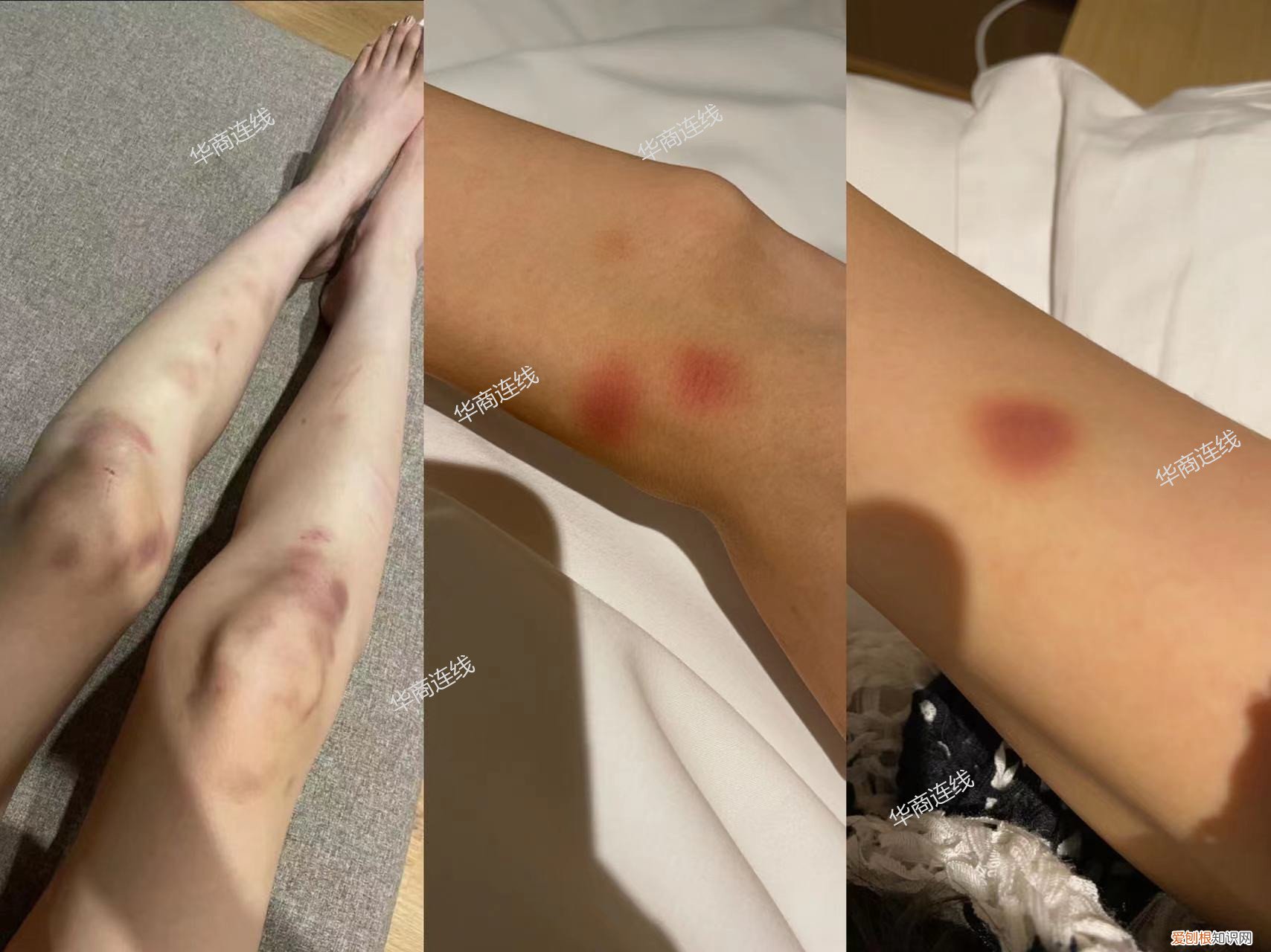 女子回应已婚高管致其流产后道歉