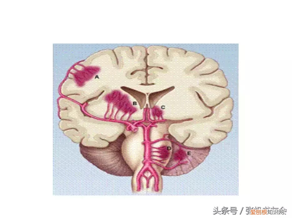 人体内脏解剖图解高清