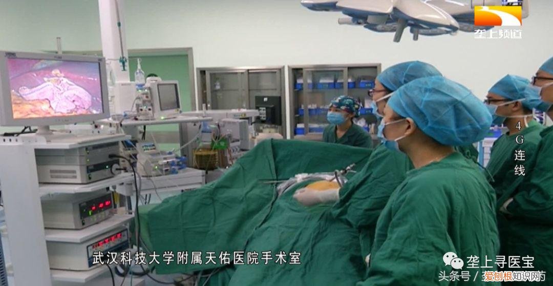 腹腔镜手术视频