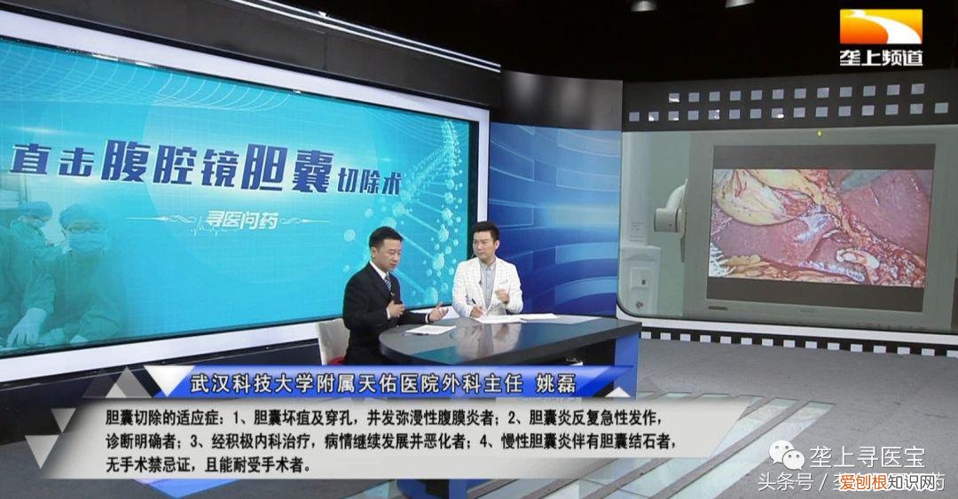 腹腔镜手术视频