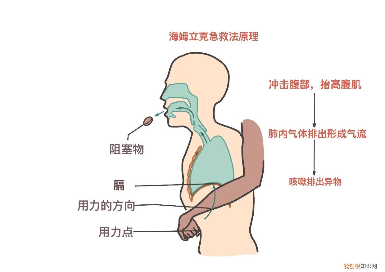 海姆立克急救法图解高清，超详细图解