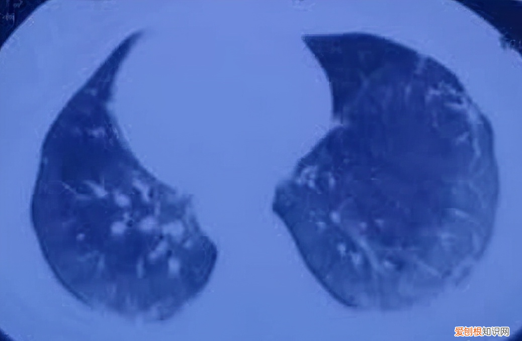 河北邢台18岁女孩被姐夫投毒百草枯，简直丧心病狂