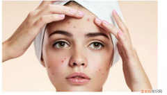 怎样去痘印最快