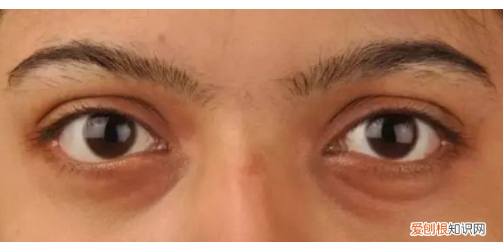 什么牌子眼霜去黑眼圈效果好