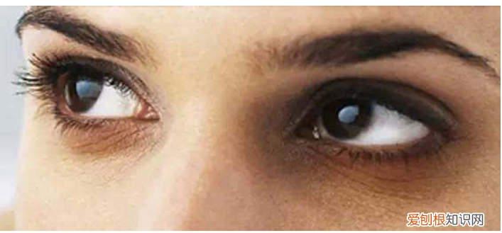 什么牌子眼霜去黑眼圈效果好