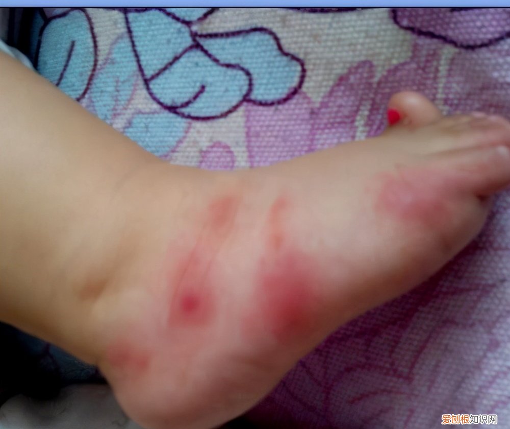 婴儿小孩子防蚊子叮咬的最好办法