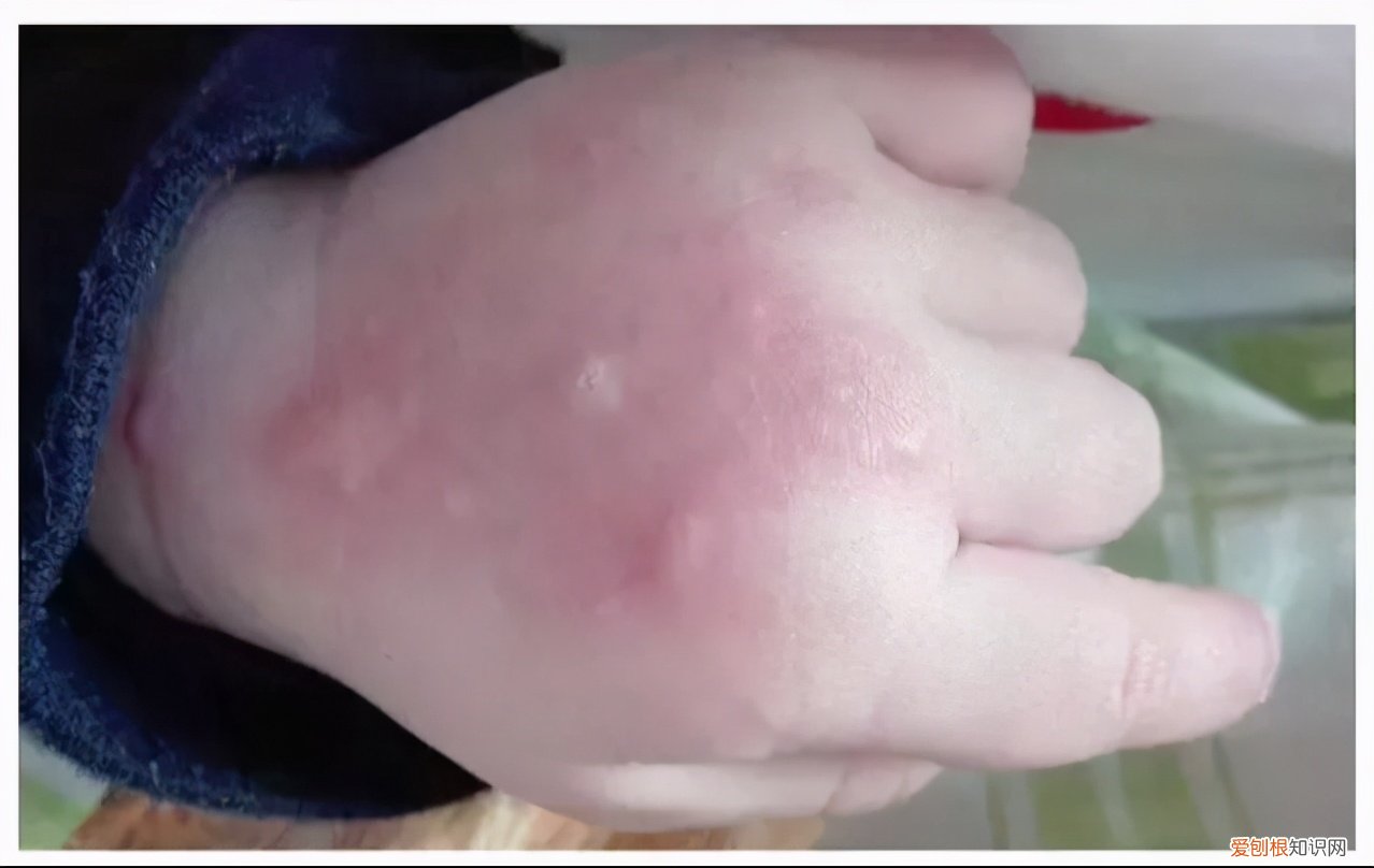 婴儿小孩子防蚊子叮咬的最好办法