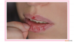 润唇膏哪个牌子好用滋润效果好又健康？